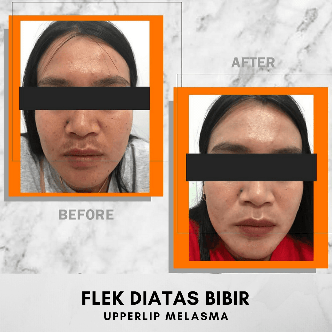 Hasil Treatment 1