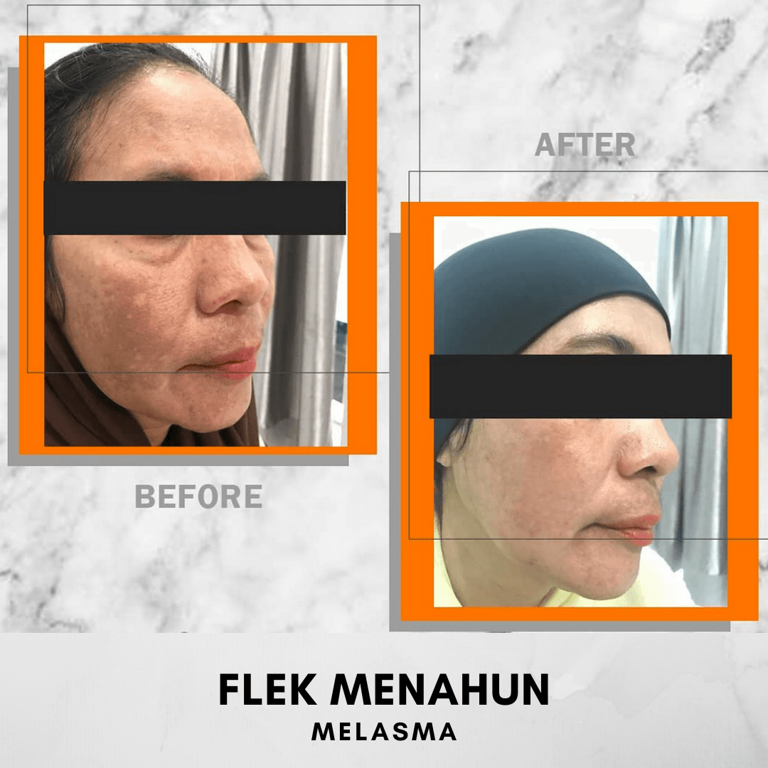 Hasil Treatment 2