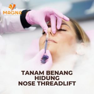 Read more about the article Tanam Benang Hidung