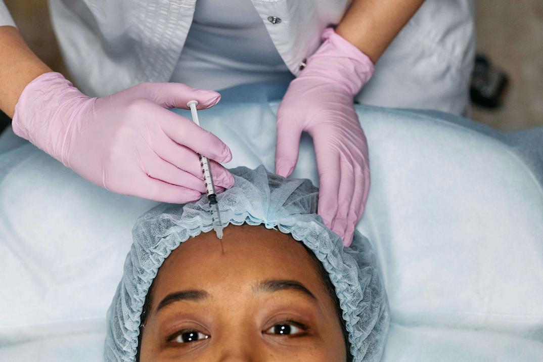 botox wajah