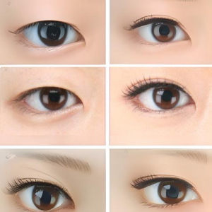 Read more about the article Eyelid Surgery: Pengertian, Tujuan, Persiapan dan Prosedurnya