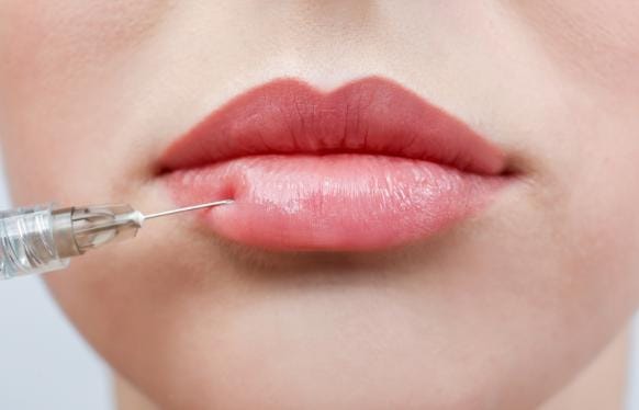 filler bibir