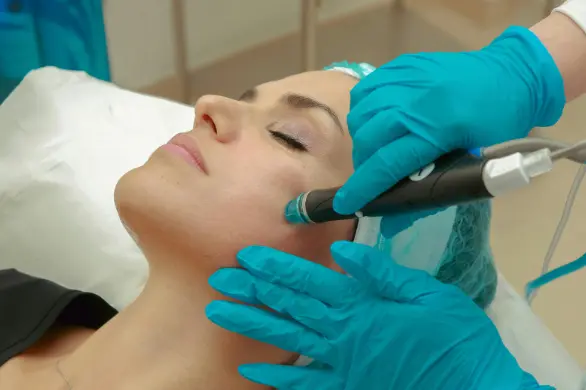 Dermapen Treatment