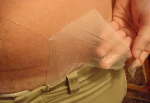 Read more about the article Body Peeling Treatment: Apa Itu?, Manfaat dan Prosedurnya