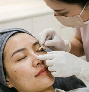 Read more about the article Tanam Benang Hidung 2: Hasil, Perawatan & Estimasi Harga [2026]