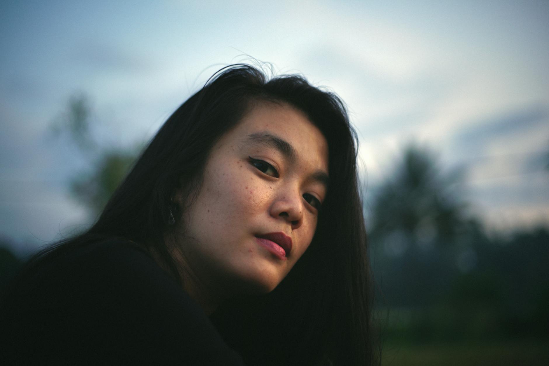 Read more about the article 9 Cara Memudarkan Flek Hitam Wajah Sesuai Penyebabnya