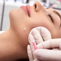 tanam benang jakarta threadlift magna